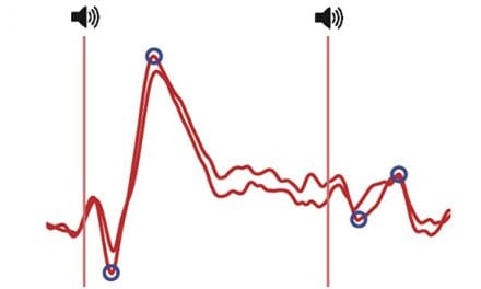Researchers Study Mechanism behind Auditory Sensory Gating