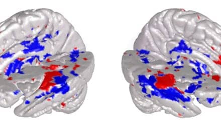 Musical Brain-reading Sheds Light on Neural Processing of Music