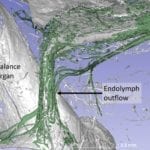 Drainage System Thought to Play a Role in Meniere’s Disease Identified